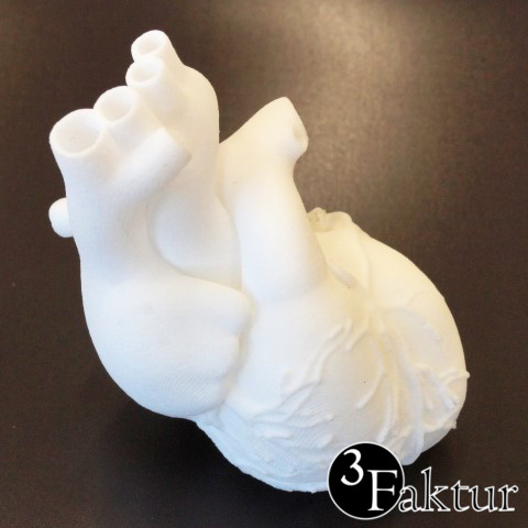 Kosten Lasersintern 3D Druck Beispiel anatomisches Herzmodell