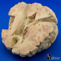3D-gedrucktes Modell eines Gehirns