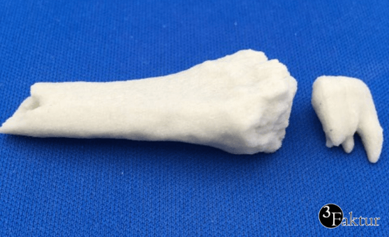 3D-gedruckte Nachbildung von Knochen